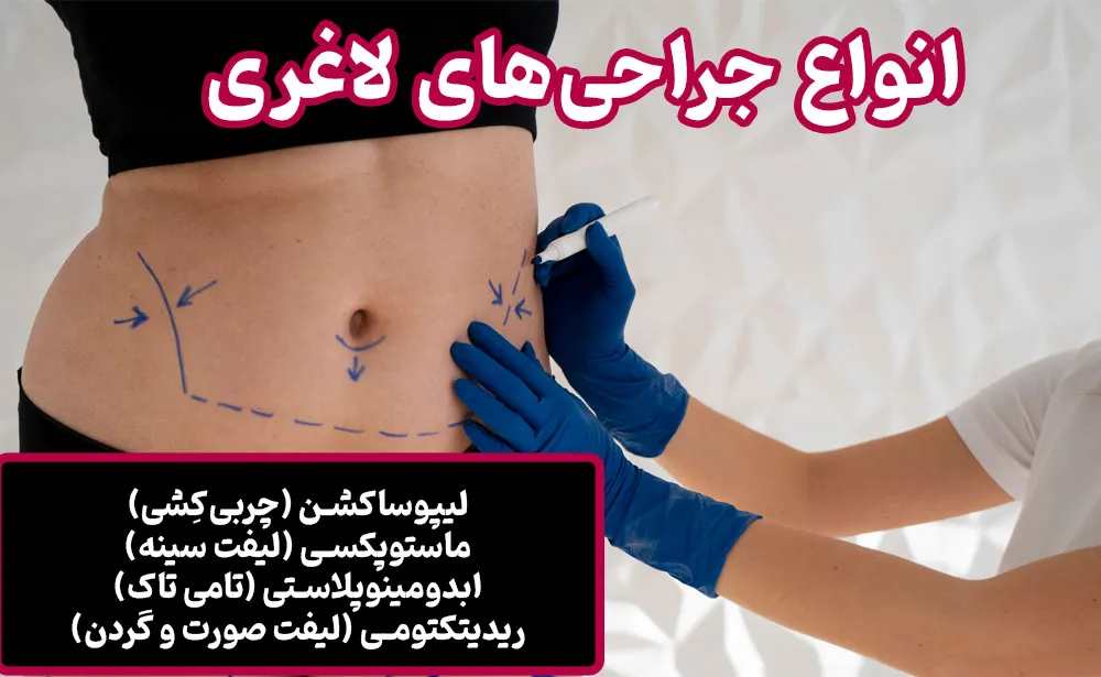 بهترین روش برای لاغری موضعی چیست