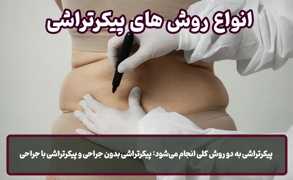 انواع روش های پیکرتراشی