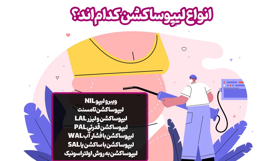انواع لیپوساکشن کداماند؟