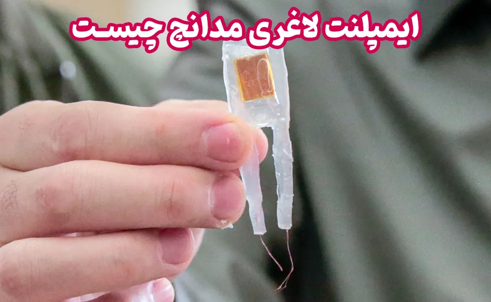 ایمپلنت لاغری مدانچ چیست- عکس ایمپلنت لاغری