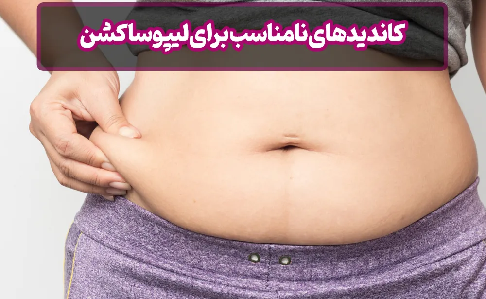 کاندیدهای نامناسب برای لیپوساکشن: