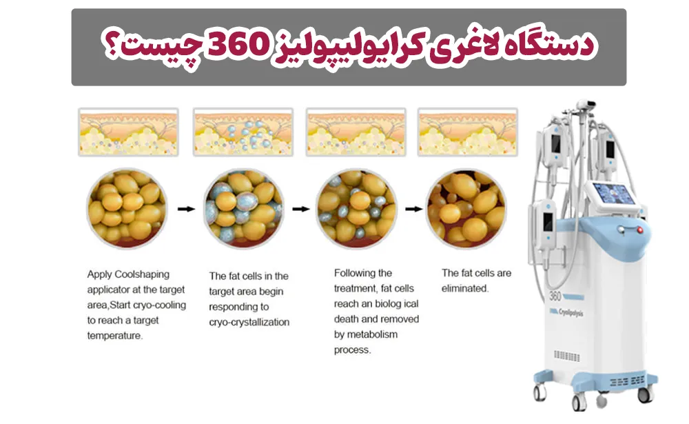 آیا کرایولیپولیز لاغر می کند