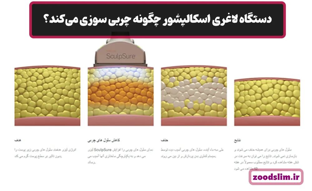 دستگاه لاغری اسکالپشور چگونه چربی سوزی می‌کند؟