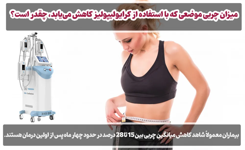 میزان چربی موضعی که با استفاده از کرایولیپولیز کاهش می‌یابد، چقدر است؟