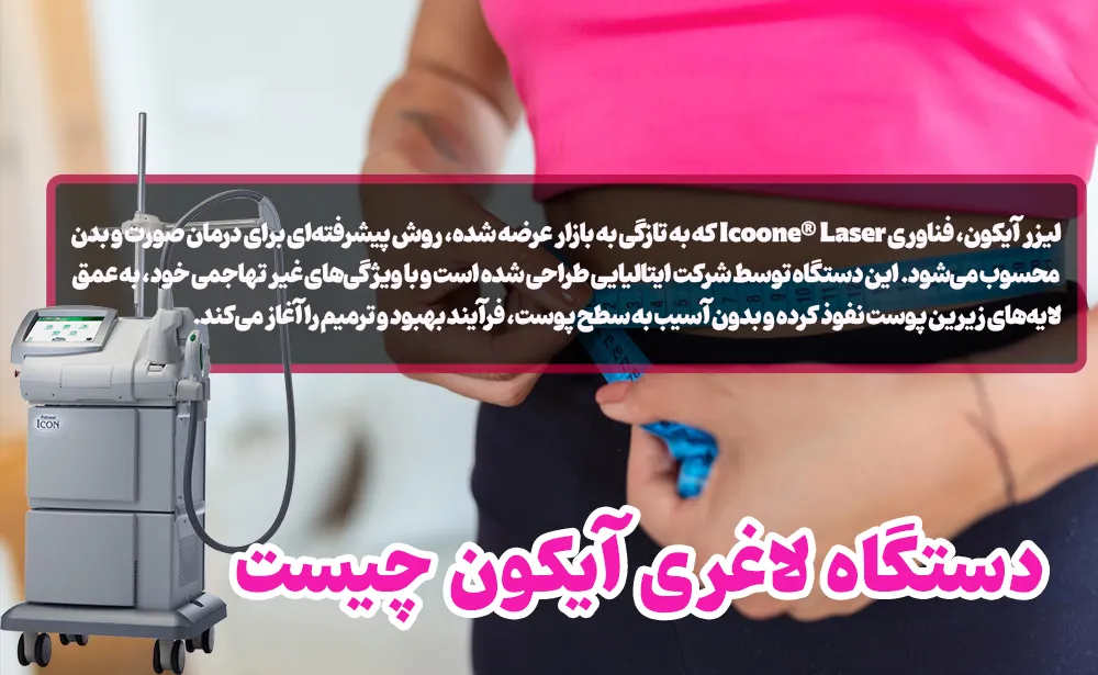 دستگاه لاغری آیکون چیست؟